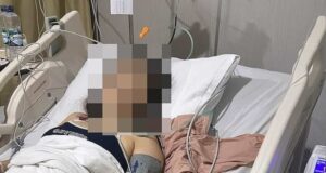 Bali: Tote und über 20 Verletzte nach Vergiftung im Hostel