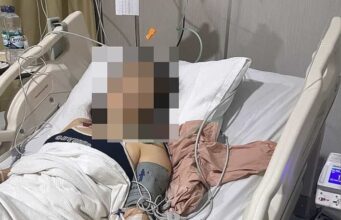 Bali: Tote und über 20 Verletzte nach Vergiftung im Hostel